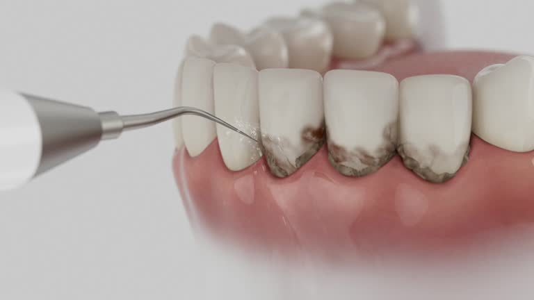 Reliable Teeth Cleaning And Checkup contractor in Montgomery County County, IA by Dentist Open Now